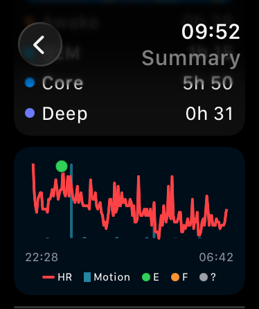 NightMonitor night summary